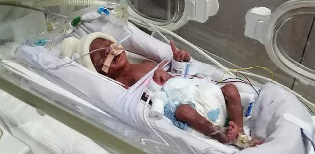 أحد أطفال الأسرة النيجيرية التي تتلقى العلاج في مستشفى لطيفة في دبي 