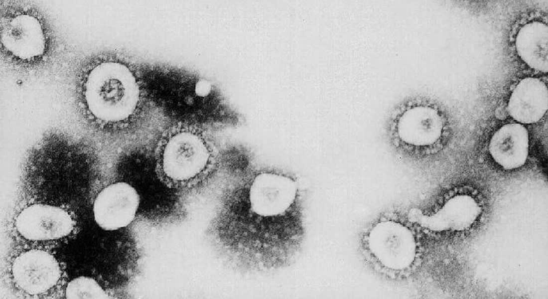 أسئلة وإجابات عن فيروس "كورونا" القاتل؟
