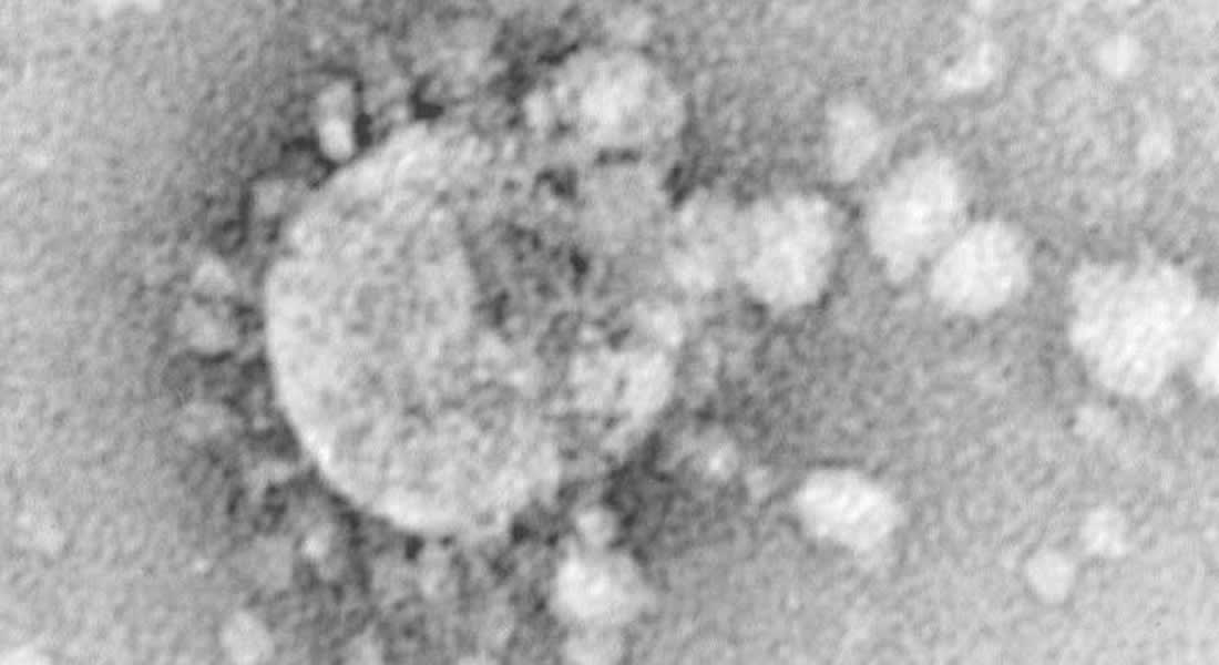 الإمارات: تشخيص إصابة بفيروس كورونا لمريض بأبوظبي