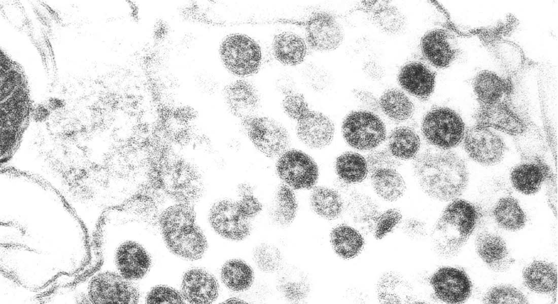 الإمارات: 3 إصابات بفيروس كورونا بأبوظبي