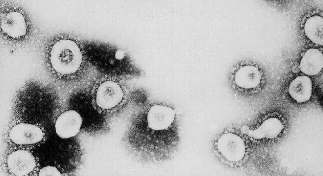 الجزائر تسجل أول حالة وفاة بفيروس كورونا
