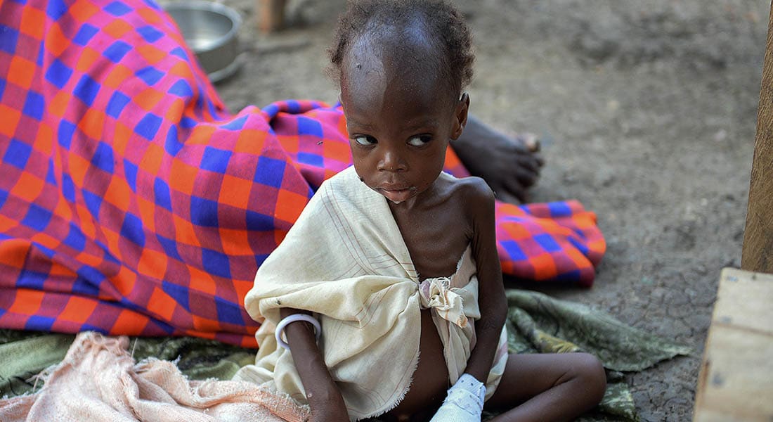 صحف العالم: تحذيرات من موت عشرات الآلاف من الأطفال جوعا في جنوب السودان