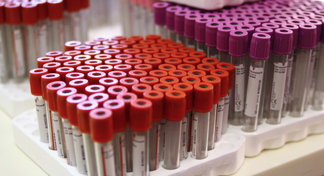 جهاز محمول لمعرفة النتيجة الفورية لاختبار الدم
