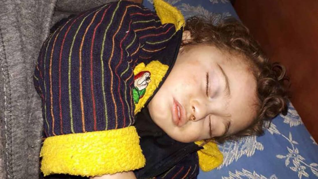 صورة من الغوطة الشرقية.. لغز يلف هذا الرضيع