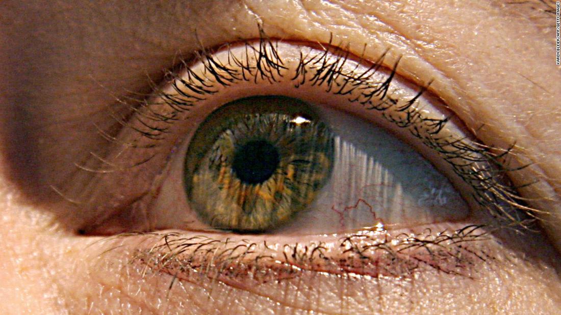 7 أعراض قد تعاني منها العين خلال النظر إلى كسوف الشمس