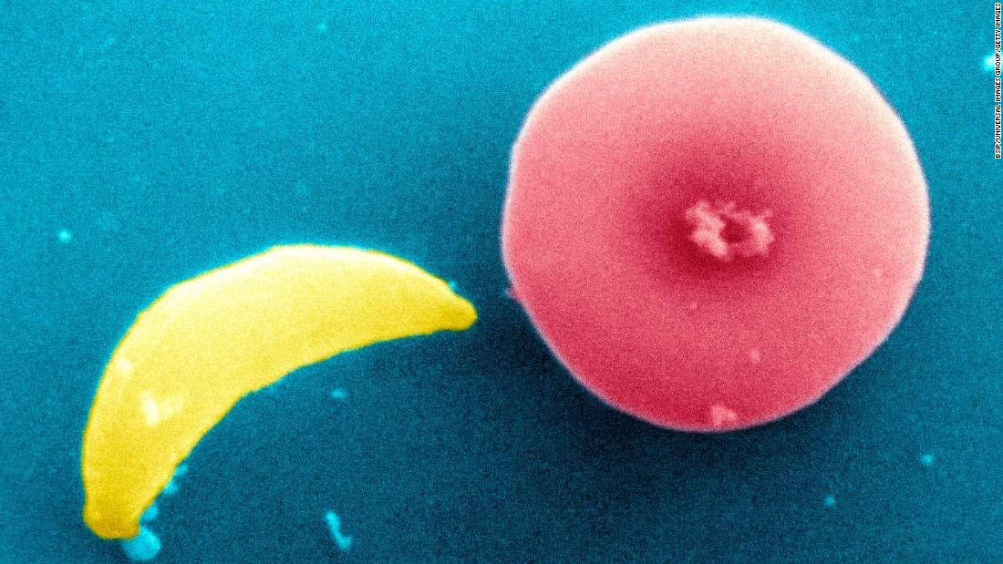 هل يمكن استخدام التكنولوجيا المستخدمة في صنع لقاح فيروس كورونا في علاج الإيدز والسرطان؟