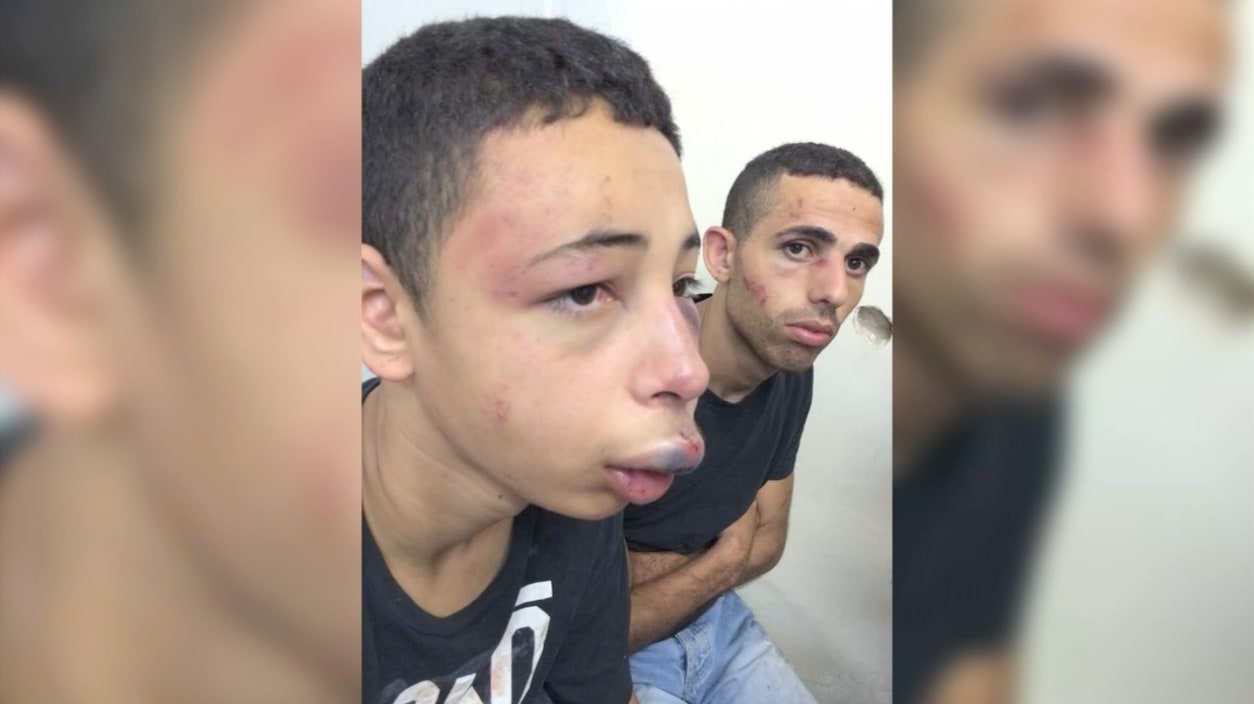 عائلة فتى أمريكي من أصل فلسطيني: عناصر أمنية إسرائيلية ضربته بعنف