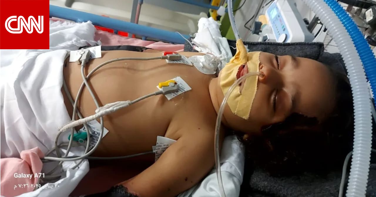 "حبيبة" رضيعة غزة أمامها أيام فقط قبل الموت وإسرائيل أوقفت إجلاءها الطبي