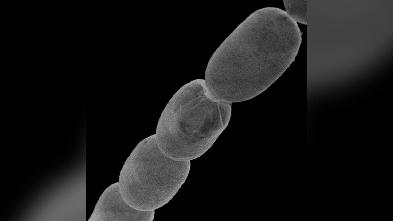 اكتشاف أكبر بكتيريا في العالم يضاهي حجمها رمش العين.. أين؟ 