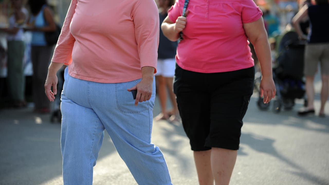 دراسة: المراهقون الذين فقدوا الوزن بعد جراحة علاج السمنة عانوا من عظام أضعف لاحقًا