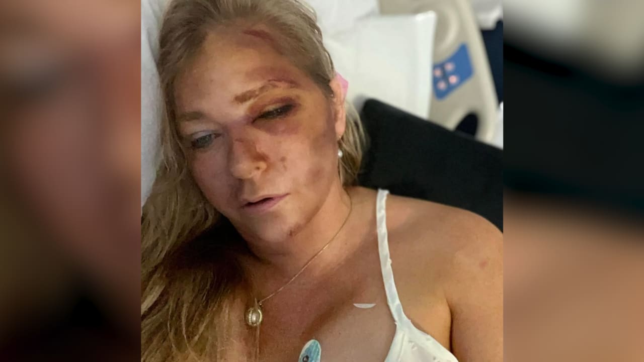 اتهمت جيفري إبستين باستغلالها جنسيًا.. رواية فيرجينيا جوفري بعد حادث سيارتها تثير الجدل