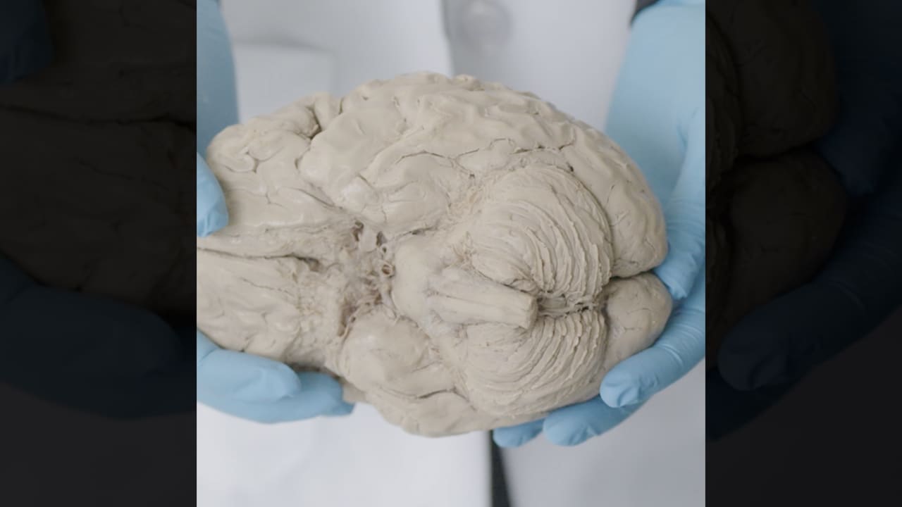 ​هل استخدام القنب آمن للجنين خلال فترة الحمل؟