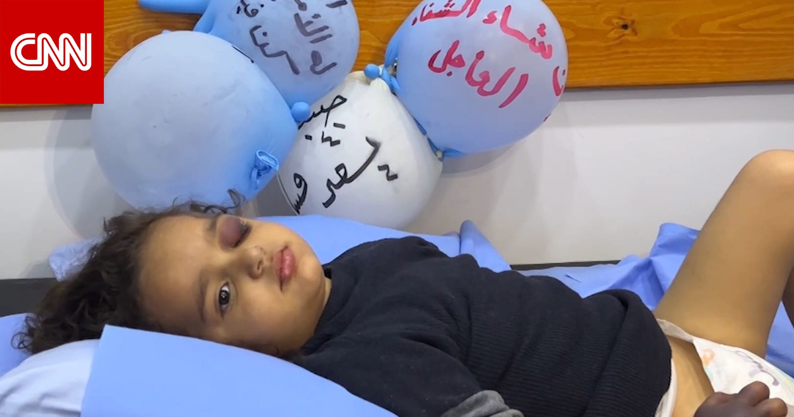 مرض نادر ينهش جسدها.. طفلة فلسطينية تنتظر إجلاءها من غزة للعلاج