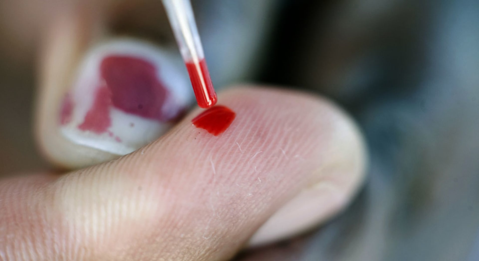 https arabic cnn com scitech 2016 02 29 anemia important facts