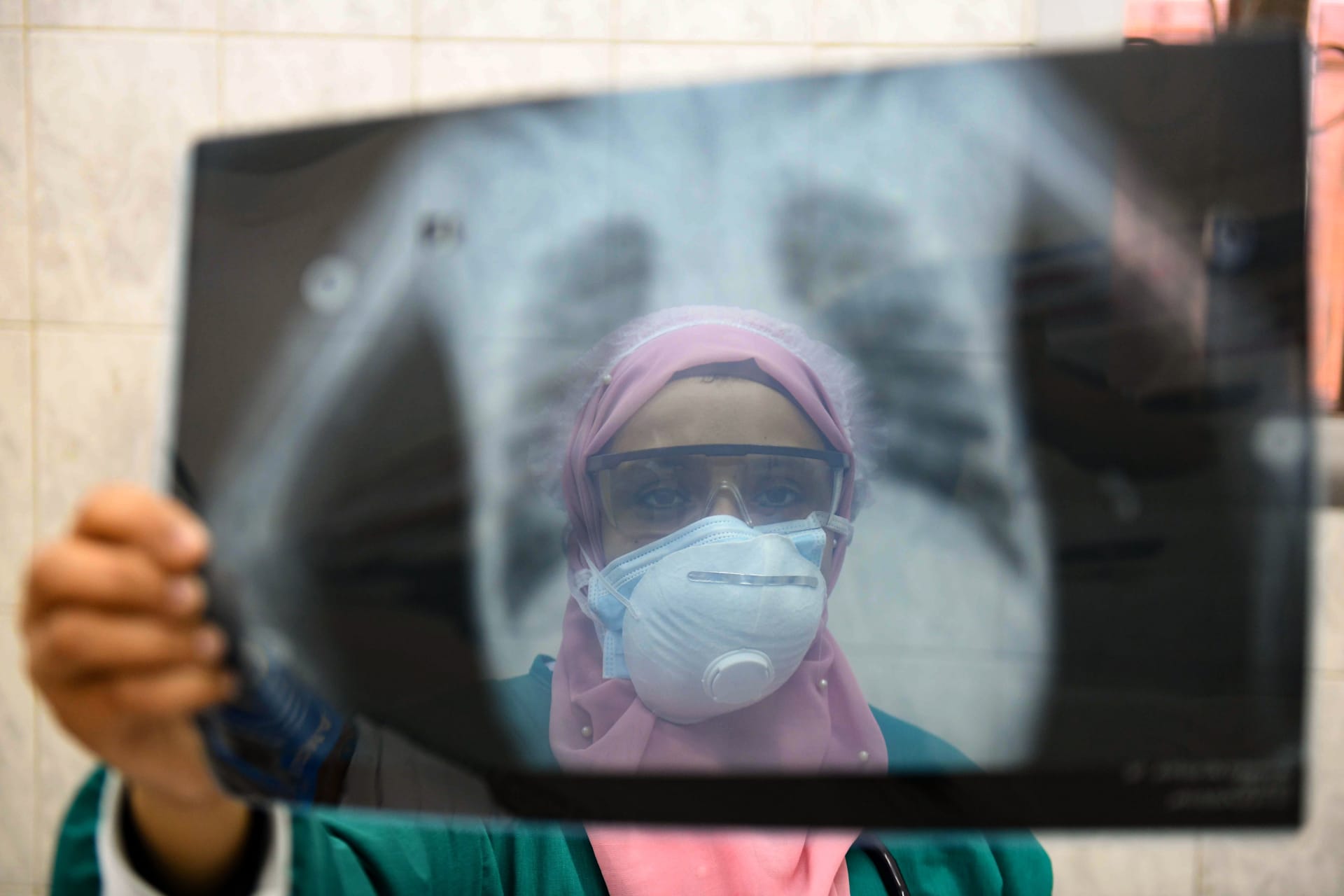 كورونا مصر.. تسجيل 272 إصابة جديدة و14 حالة وفاة بسبب الإصابة بالوباء