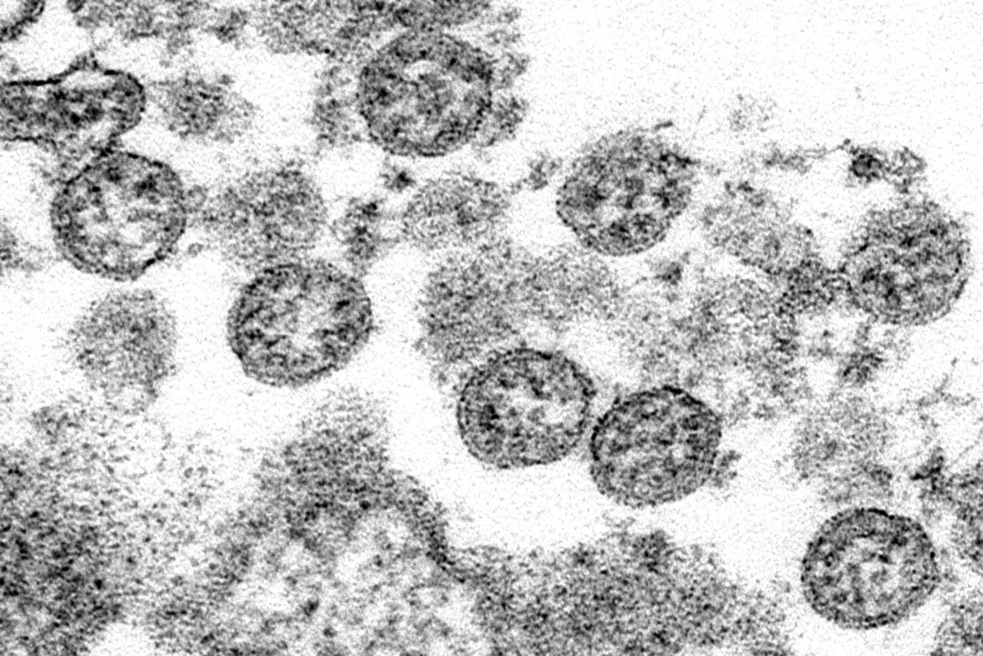 نتائج مبكرة من تجربة لقاح فيروس كورونا تنتجه "مودرنا" يظهر أن المشاركين طوروا أجساما مضادة للفيروس