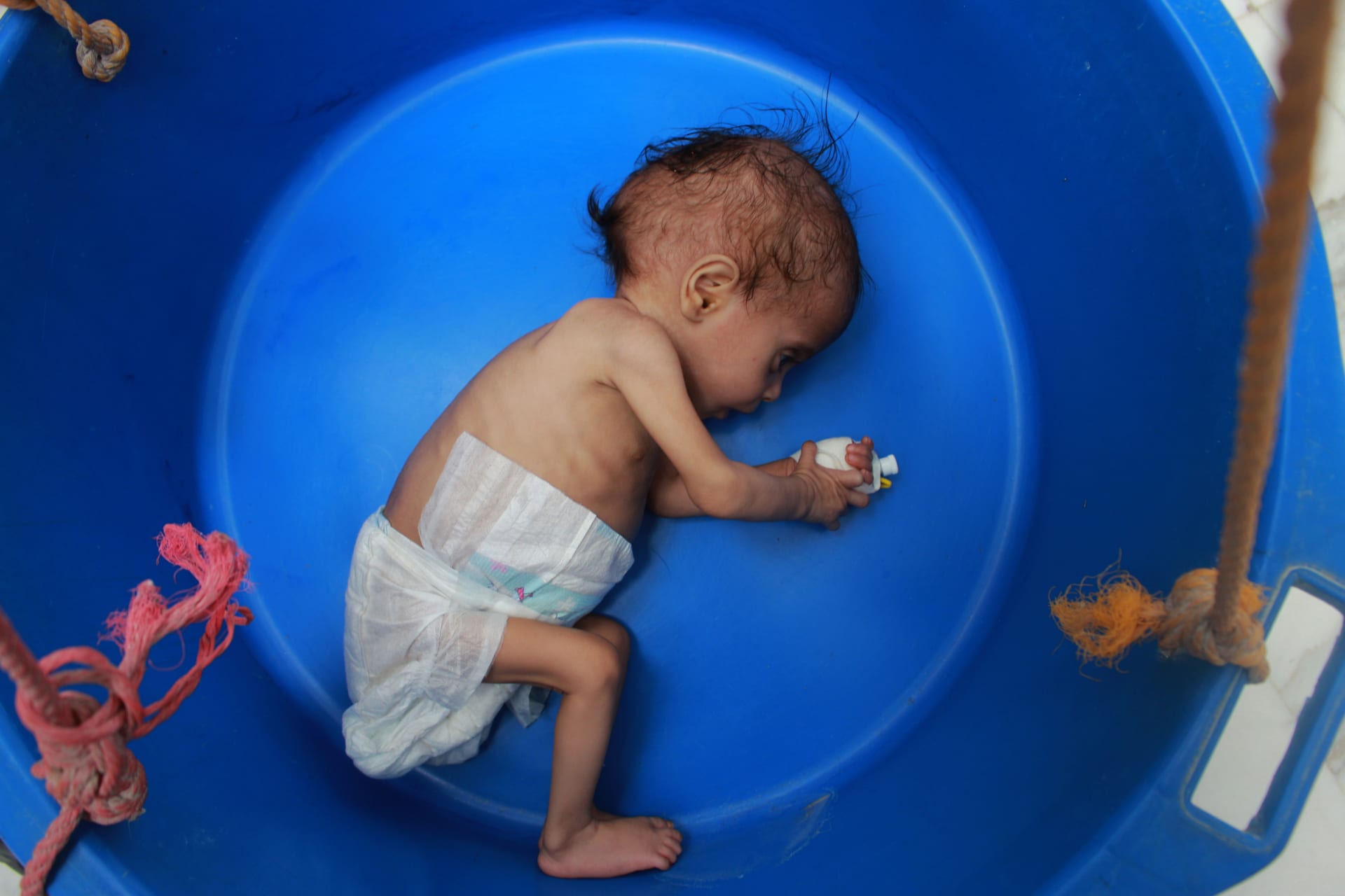 يونسيف: قرابة 7 ملايين طفل سيعانون من سوء التغذية الحاد بسبب جائحة كورونا