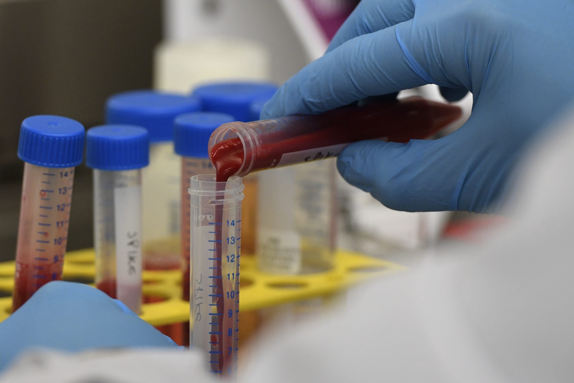 دراسة: ملعقتان صغيرتان من دم مصنّع مخبريًا قد تضعان حدًا لأمراض الدم النادرة