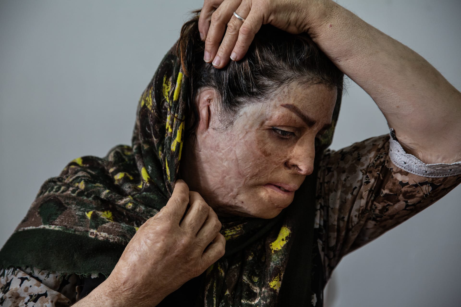 مصورة إيرانية توثق معاناة نساء كرديات حرقن أنفسهن احتجاجا على العنف الاجتماعي