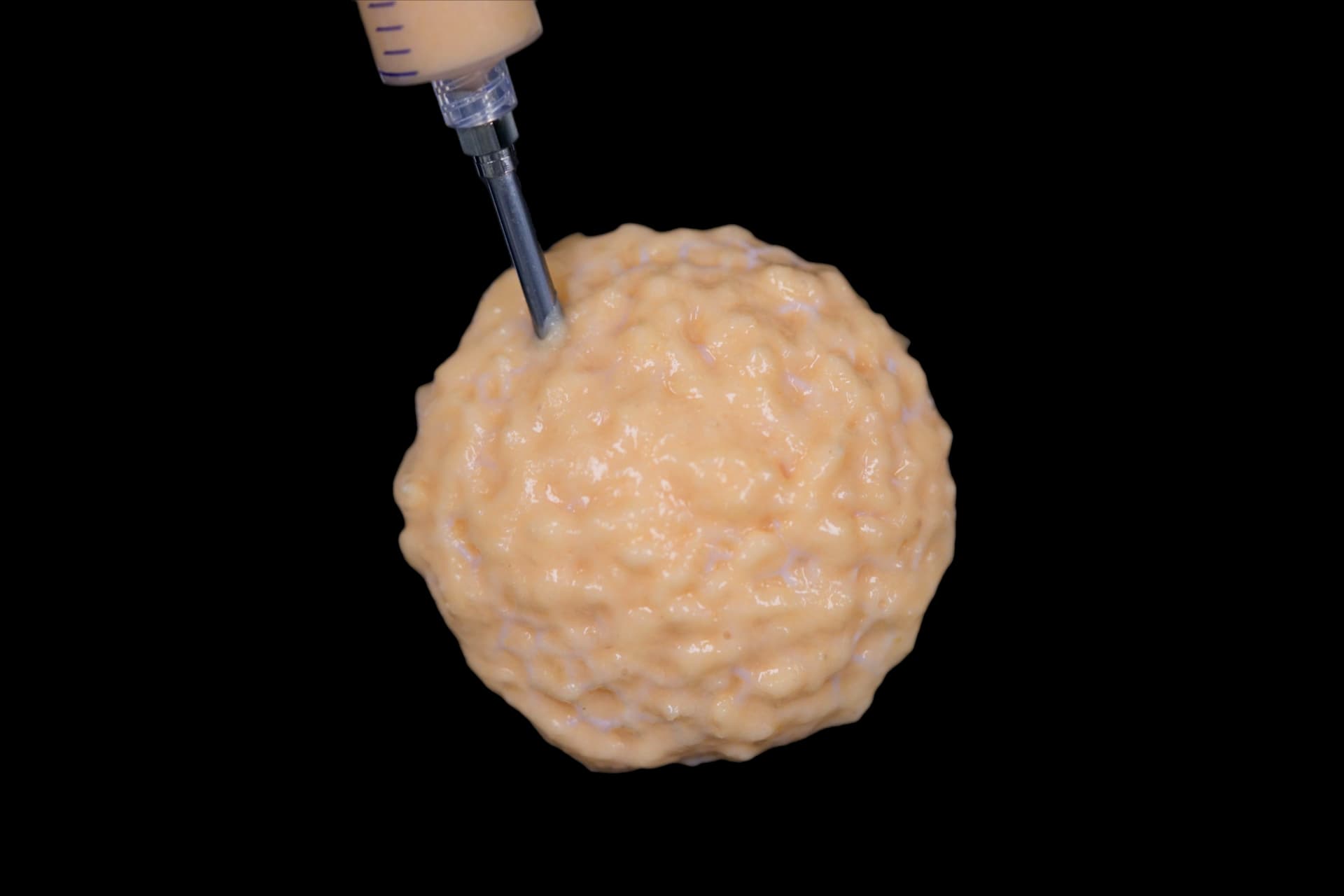 هندسة ميكانيكا حيوية تساعد مرضى السرطان