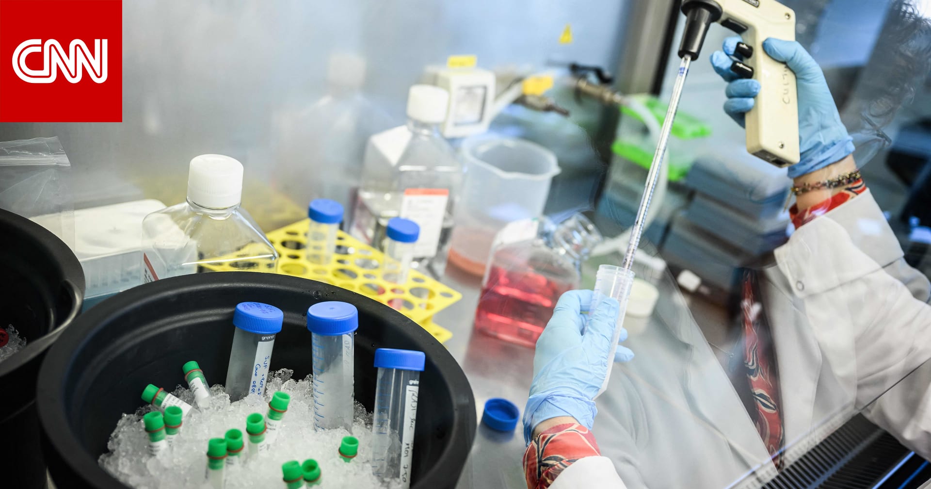 Understanding the Rising Rates of Lung Cancer in Women: Unveiling the Hidden Epidemic