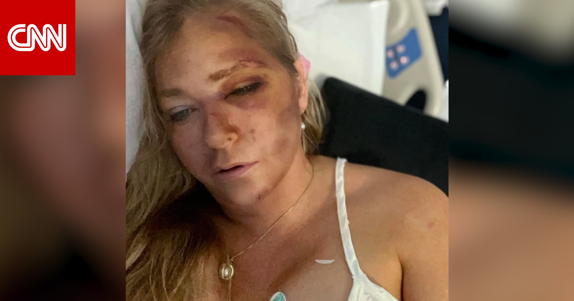 اتهمت جيفري إبستين باستغلالها جنسيًا.. فيرجينيا جوفري بحالة حرجة بعد حادث سيارة