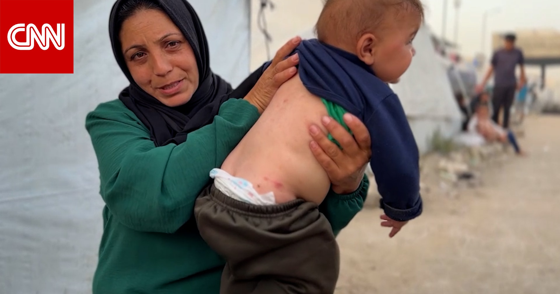 قوارض وآفات منتشرة.. أزمة صحية متفاقمة تلاحق أطفال غزة وسط تفشي الأمراض الجلدية