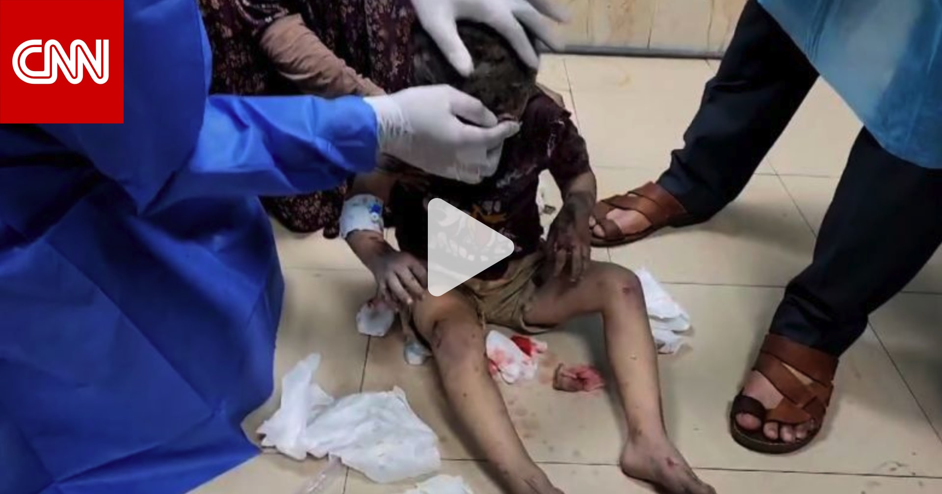 "القصف الأكثر كثافة خلال 17 يومًا".. فيديو يُظهر الوضع المزري داخل مستشفى في غزة