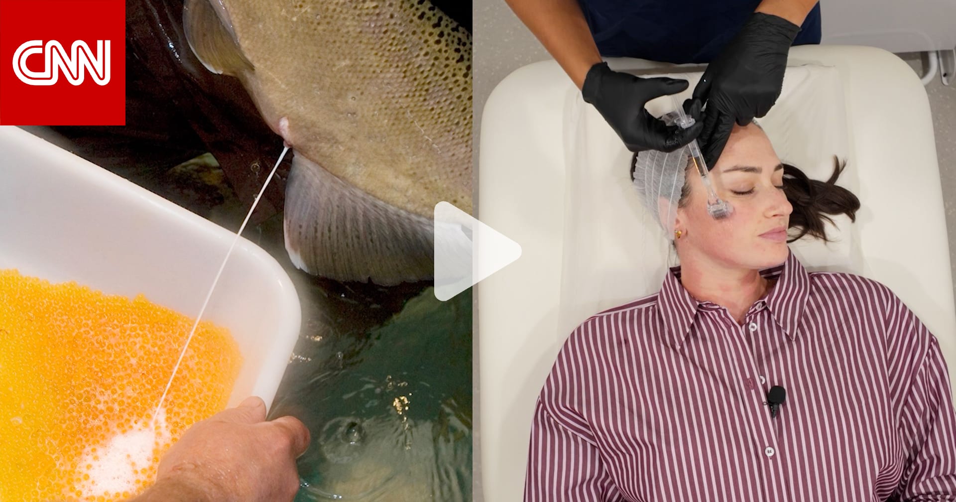 علاج الوجه بالحيوانات المنوية لأسماك السلمون.. CNN تجرّب الصيحة الرائجة 