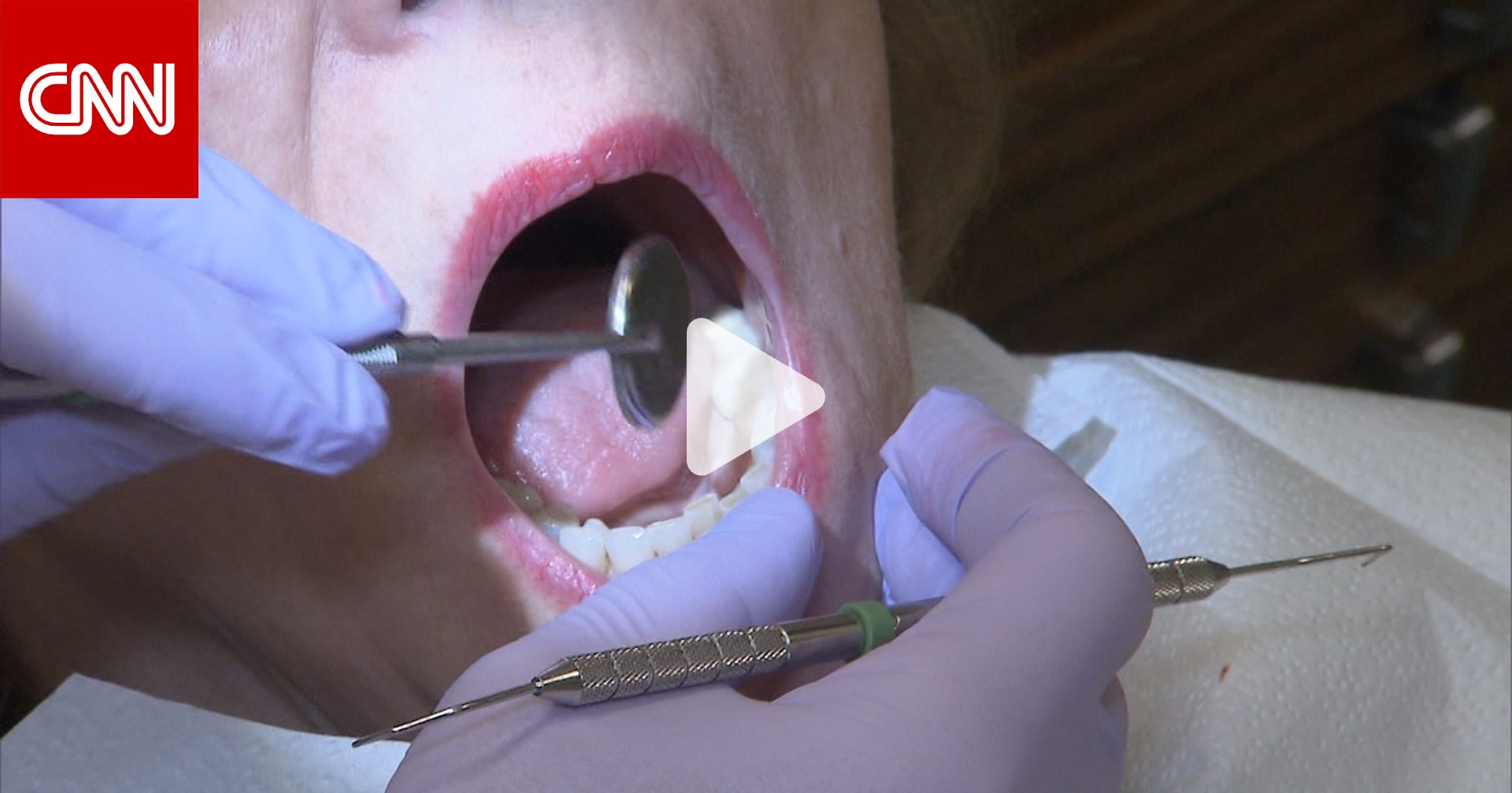 صحة فم جيدة أهم من ابتسامة جميلة..لهذا السبب يجب ألا تتجاهل ألم الأسنان 