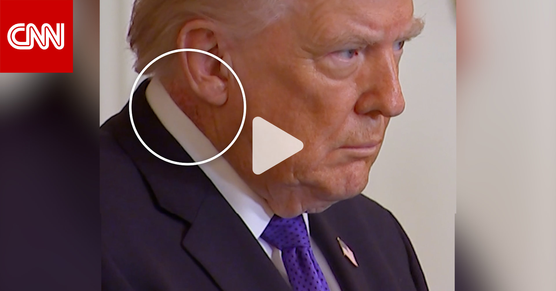 ظهور طفح جلدي جديد على رقبة ترامب.. وتساؤلات بشأن حالته الصحية 