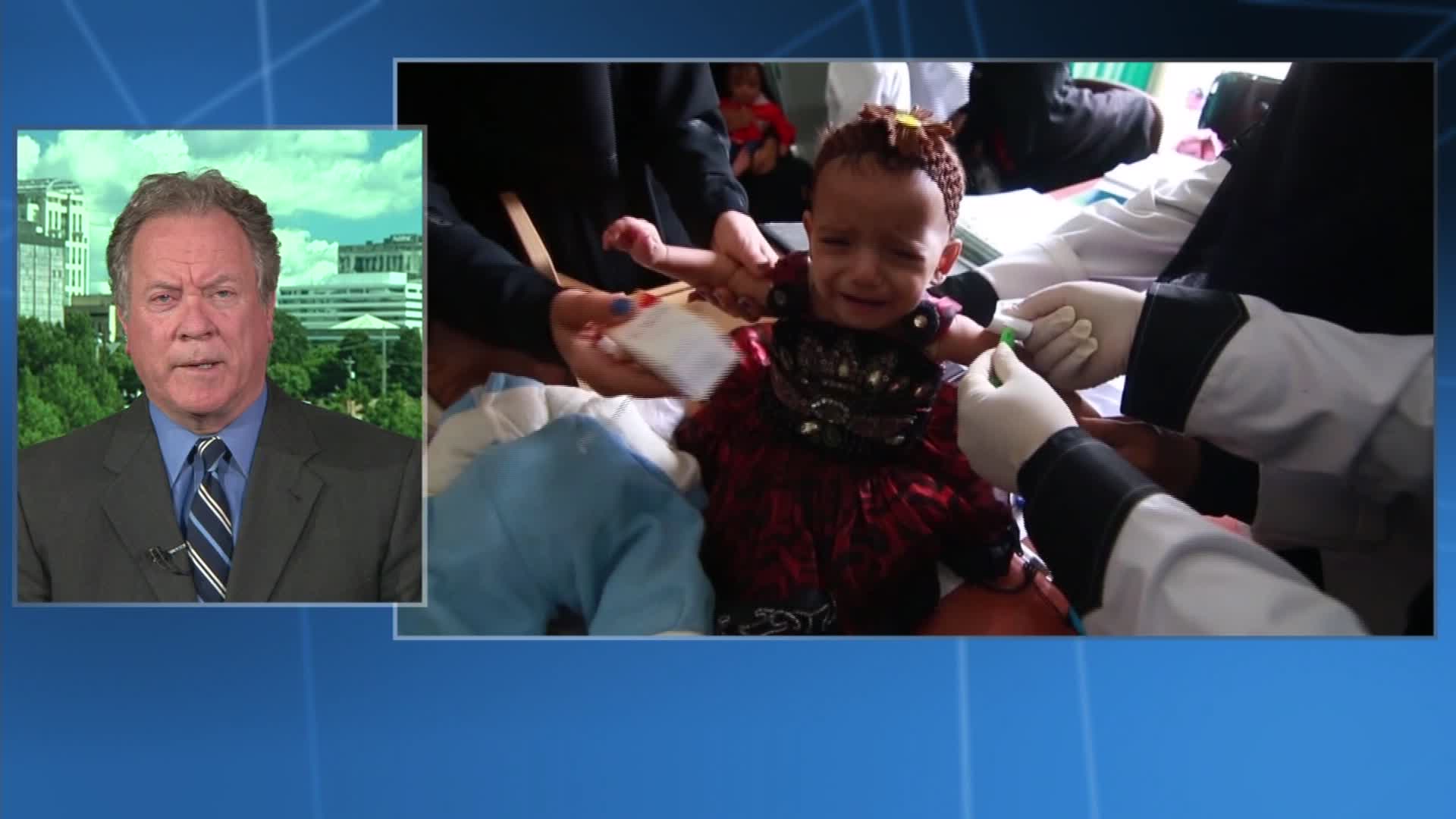 مدير "الأغذية العالمي" لـCNN: أطفال أبرياء يموتون باليمن بسبب الحوثيين