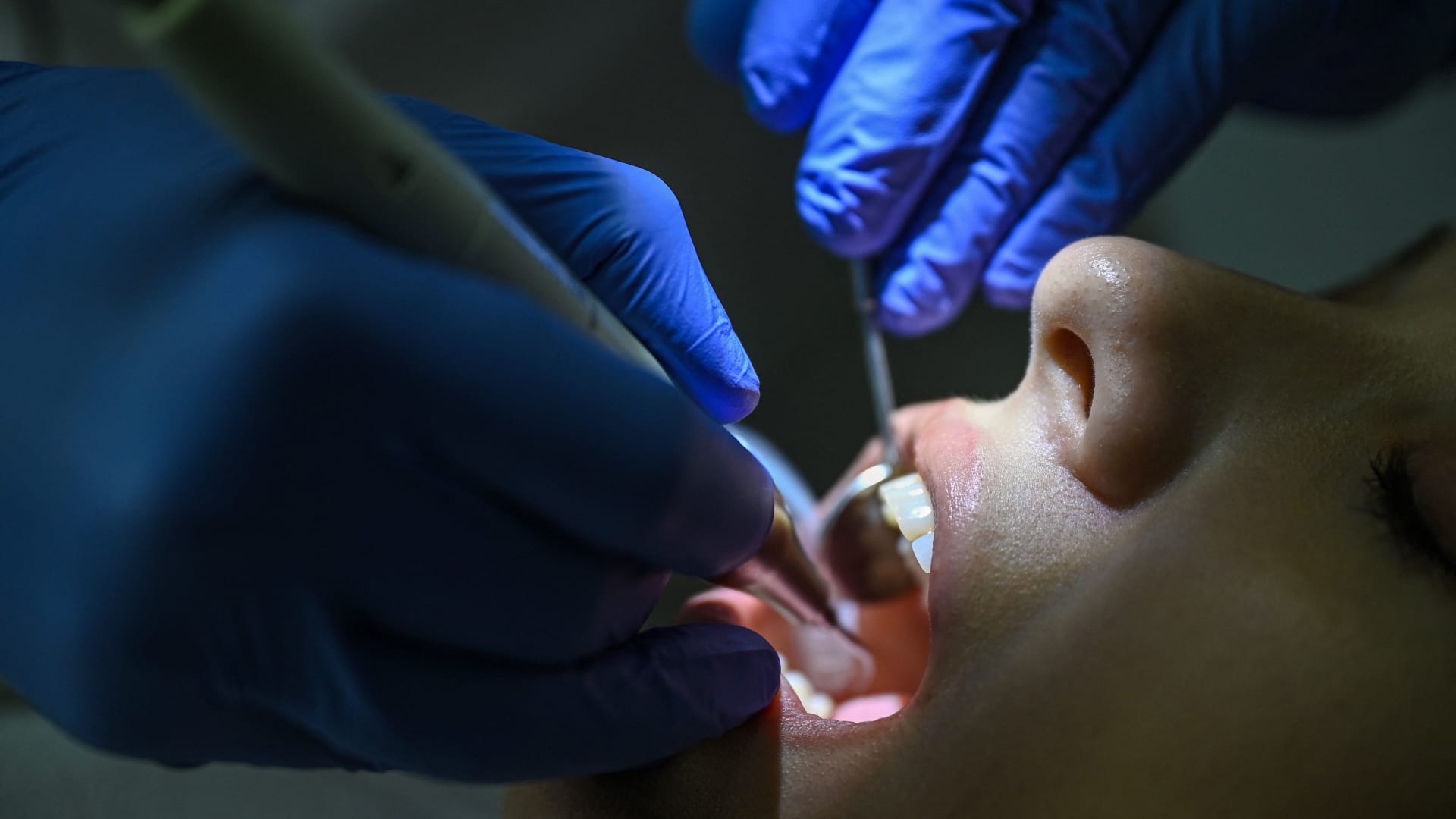 ما هو السبب الرئيسي لرائحة الفم الكريهة.. وكيف يمكن منعها؟