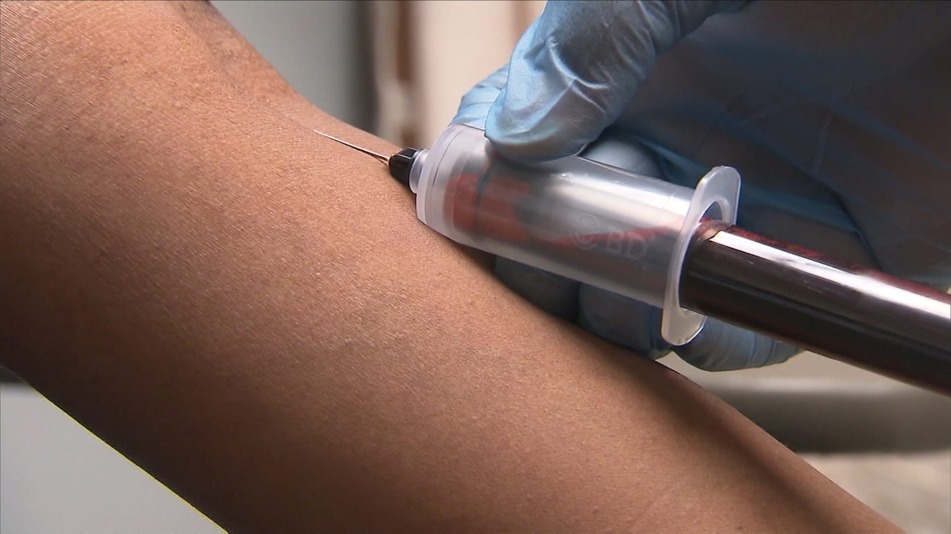 من الالتهابات إلى جلطات الدم.. إليك 5 أشياء يمكن أن يخبرك بها دمك عن صحتك 1 من الالتهابات إلى جلطات الدم.. إليك 5 أشياء يمكن أن يخبرك بها دمك عن صحتك