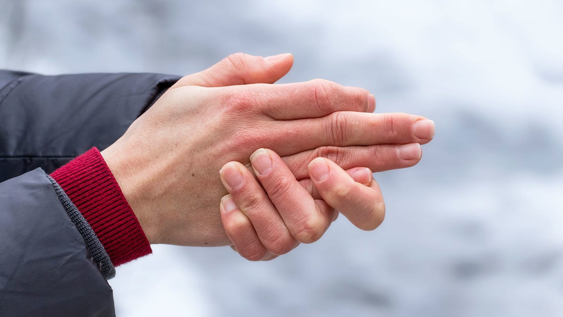 ضوء أخضر أمريكي لأول علاج لقضمة الصقيع الشديدة يقلّل من خطر بتر الأصابع