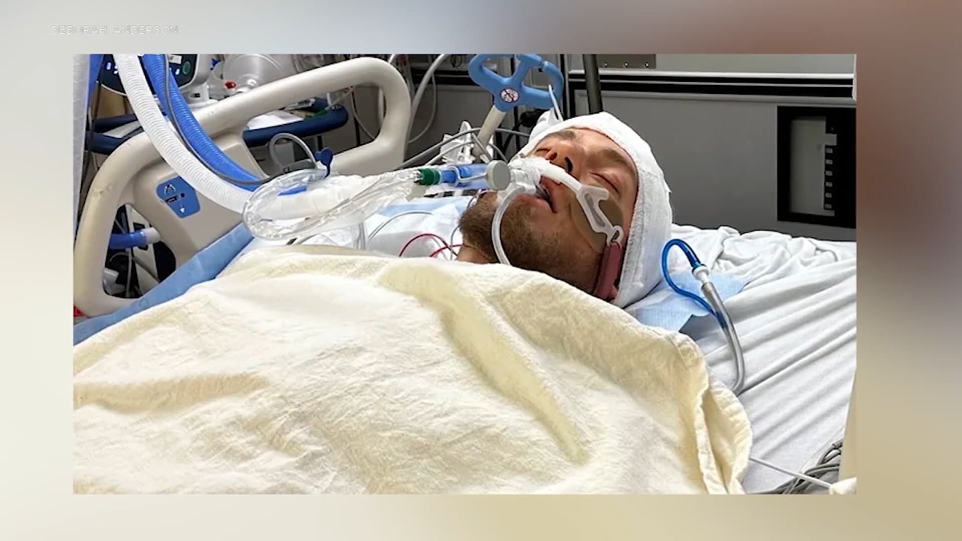 نزيف في المخ كاد يودي بحياته داخل سيارة أوبر.. ماذا فعل السائق؟