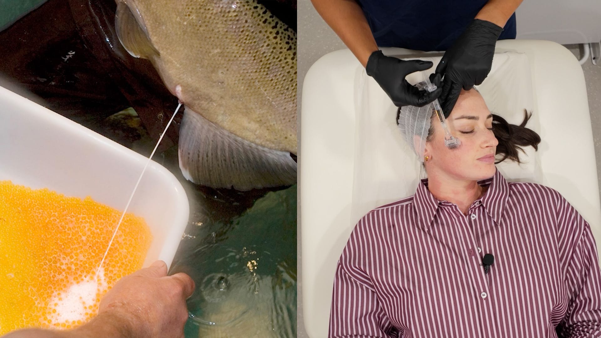 علاج الوجه بالحيوانات المنوية لأسماك السلمون.. CNN تجرّب الصيحة الرائجة