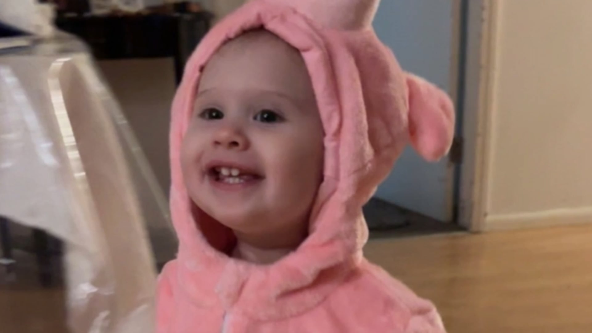 مشهد مؤلم لطفلة في عامها الأول تتعافى من هجوم كلبين من فصيلة "بيتبول".. شاهد ما حدث لها