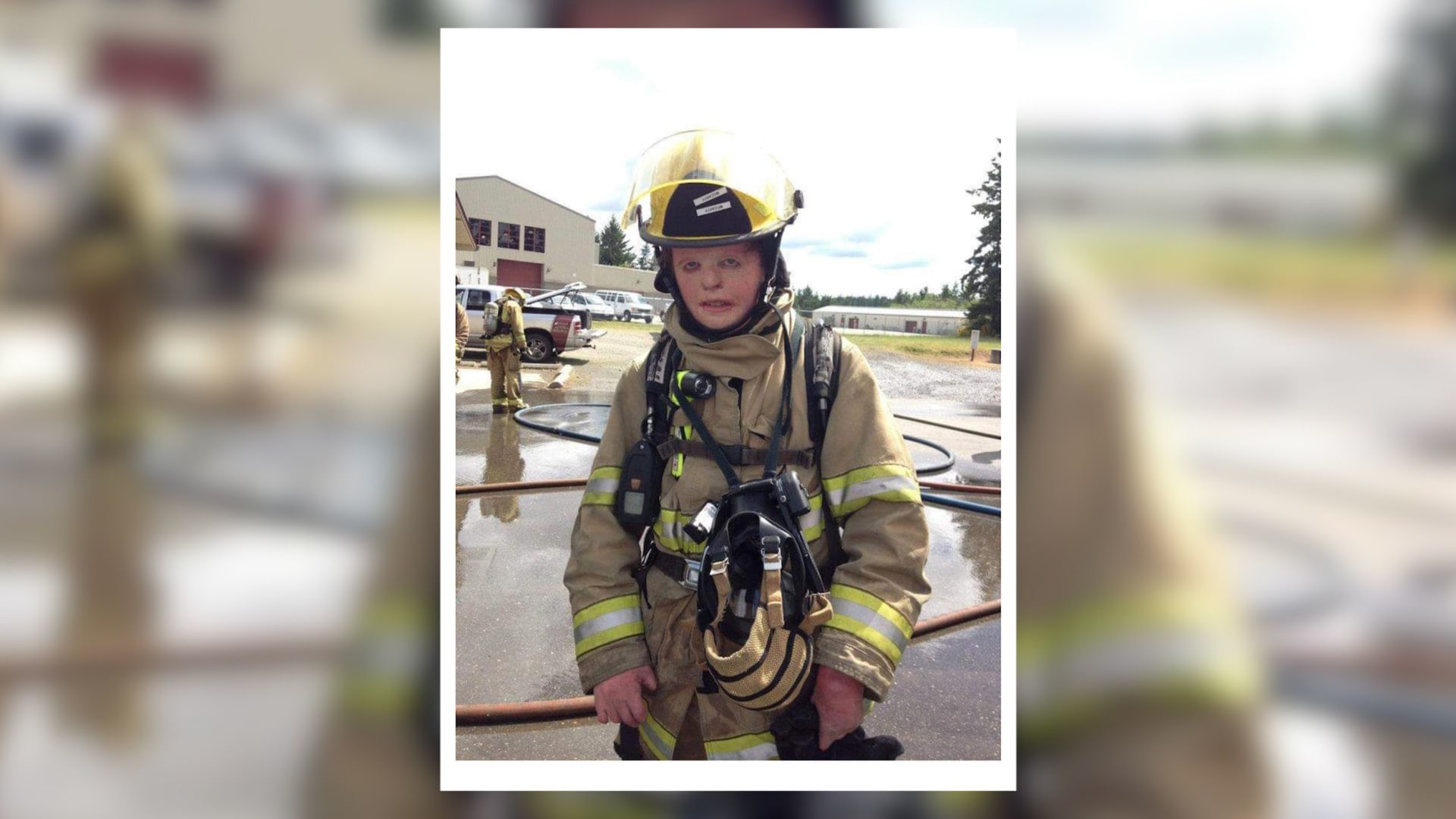 خضع لعشرات العمليات الجراحية.. ناجٍ من حادثة حروق يصبح رجل إطفاء متطوعًا