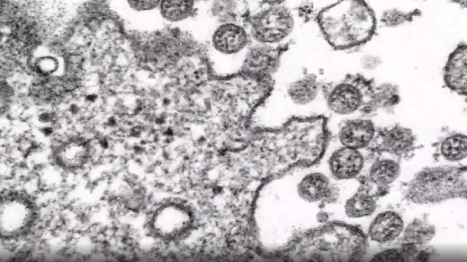 باحثون: فيروس كورونا تحوّر وقد يصبح أكثر عدوى