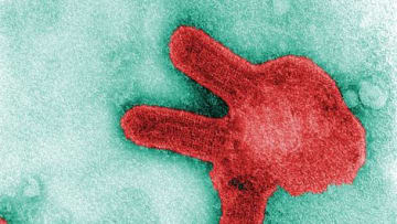 شبيه بالإيبولا.. إليك ما نعرفه عن فيروس ماربورغ النادر