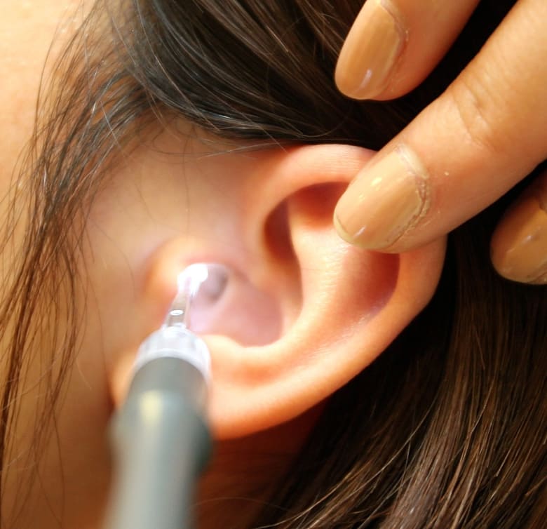 شمع الأذن كيف يتكون وما هو سبب وجوده