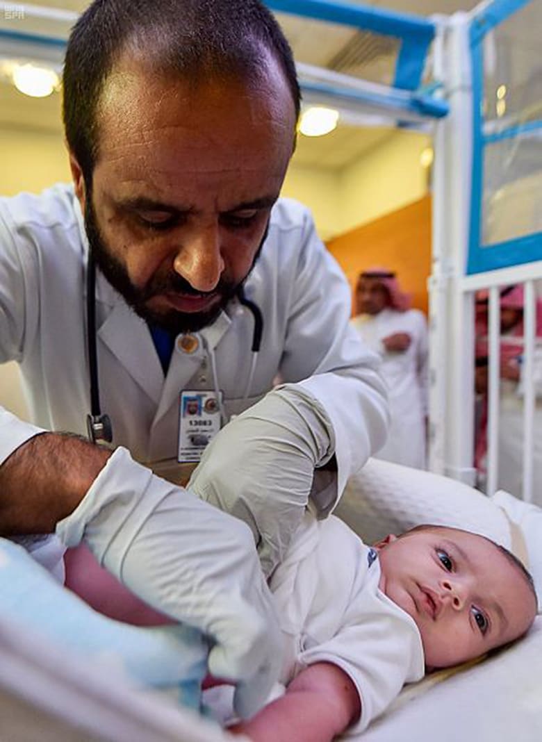 قرار مستشفى في الرياض بفصل التوأم السيامي الليبي ما نسبة نجاح العملية Cnn Arabic