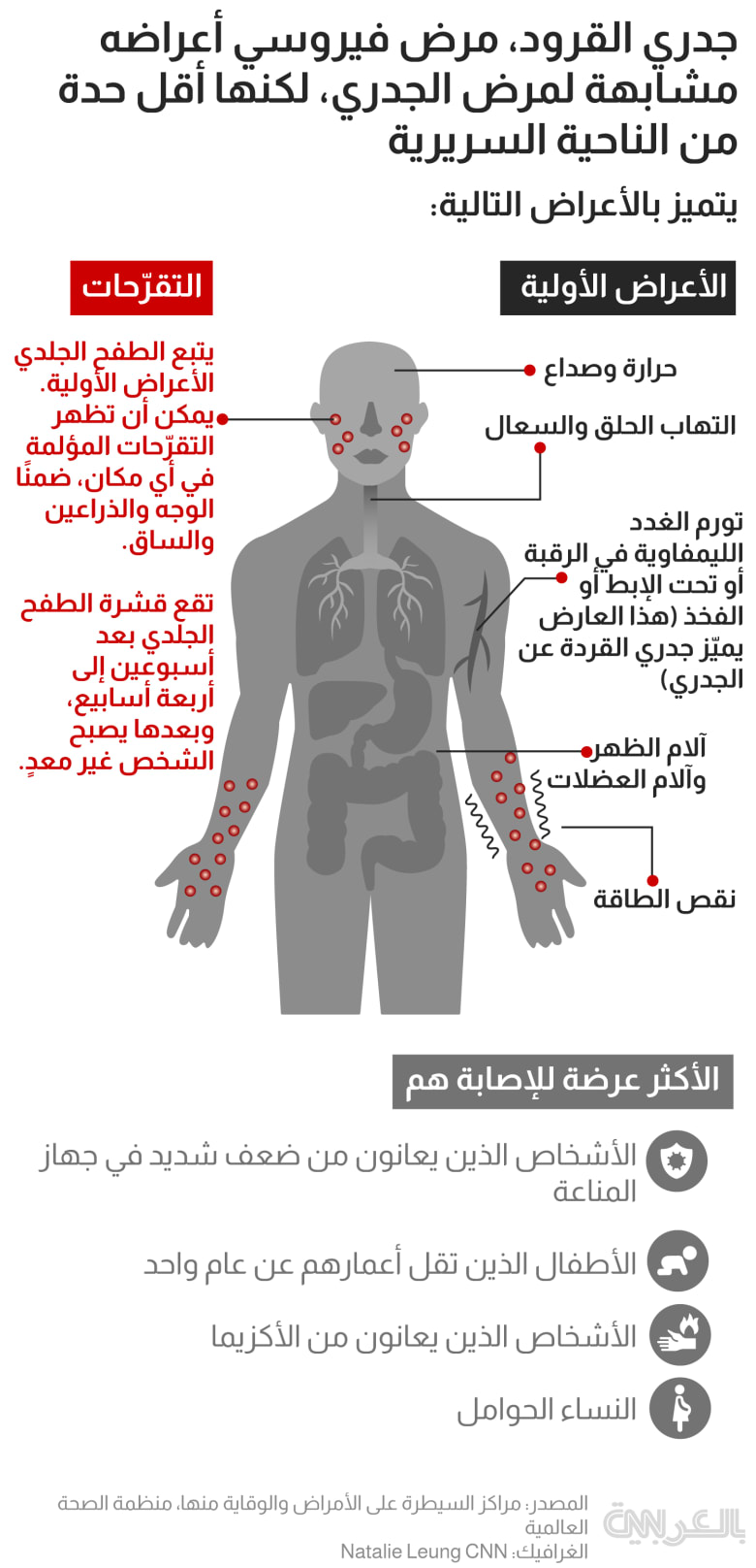 mpox symptoms