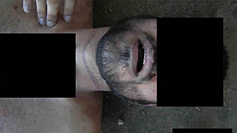 التقرير يزعم أن هذه الصورة تظهر آثار علامات بسبب الخنق. التقرير يزعم أن هذه الصورة تظهر آثار علامات بسبب الخنق.