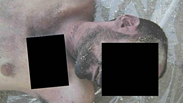صورة تظهر مزيدا من علامات الخنق. صورة تظهر مزيدا من علامات الخنق.
