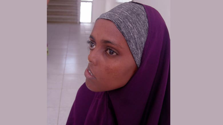 صومالية تنتظر عودة الابتسامة إلى وجهها منذ 23 عاماً صومالية تنتظر عودة الابتسامة إلى وجهها منذ 23 عاماً