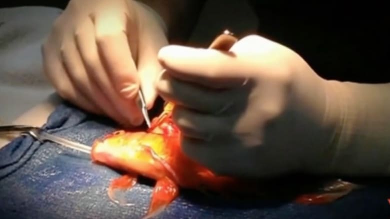 بالفيديو.. جراحة نادرة تمنح السمكة "جورج" عمراً جديداً