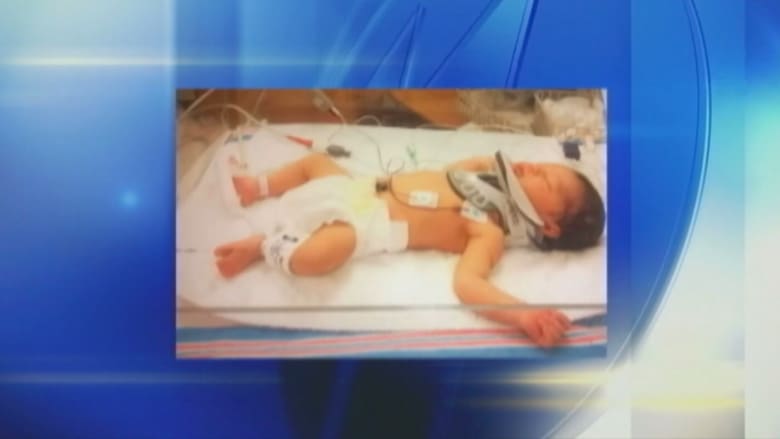 عائلة أمريكية تعيش محنة بسبب انزلاق طفلها من بين يدي الممرضة بعد ولادته