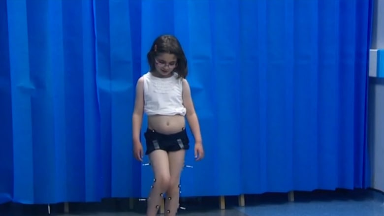بالفيديو: تقنيات هوليودية تساعد هذه الطفلة على المشي